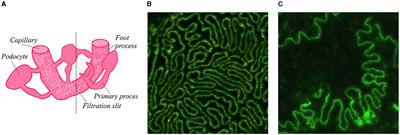 Self-supervised representation learning of filtration barrier in kidney